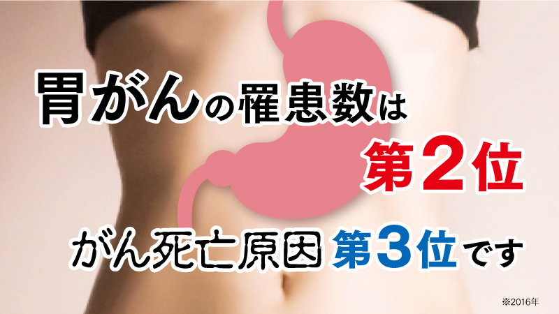 胃がんは日本人のがん死亡率第１位です